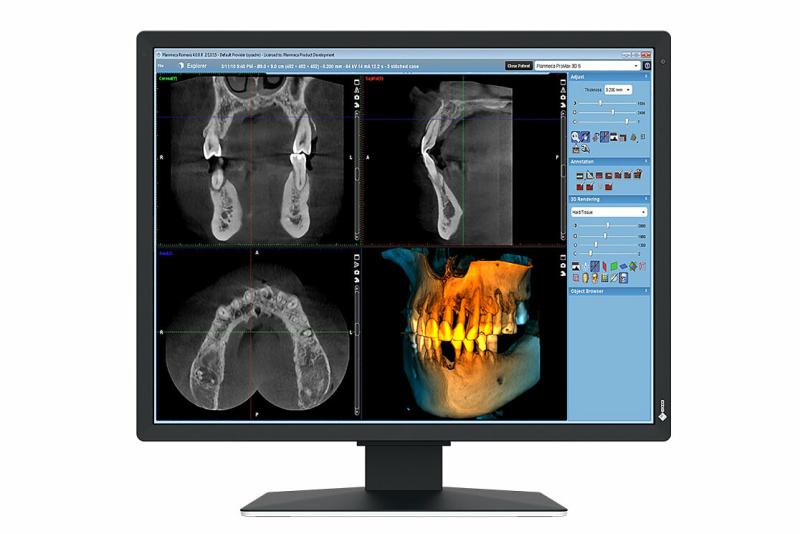 Monitor Eizo 21" MX217-SB (Monitor Consumer Eizo RadiForce MX217-SB)